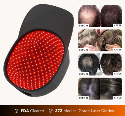 Clinically Proven Laser Cap for Hair Regrowth